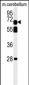 TBKB1 Antibody  (N-term)